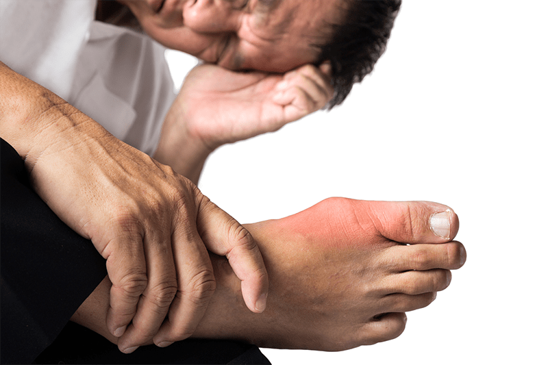 gout and joint pain 